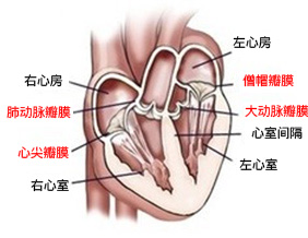 심장판막질환 사진
