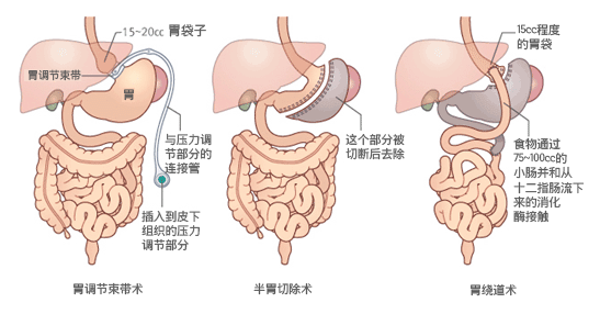 시술방법 사진