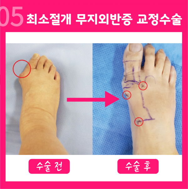 4d2a40f1d1e6d8593fbe9184d035821b_1643011