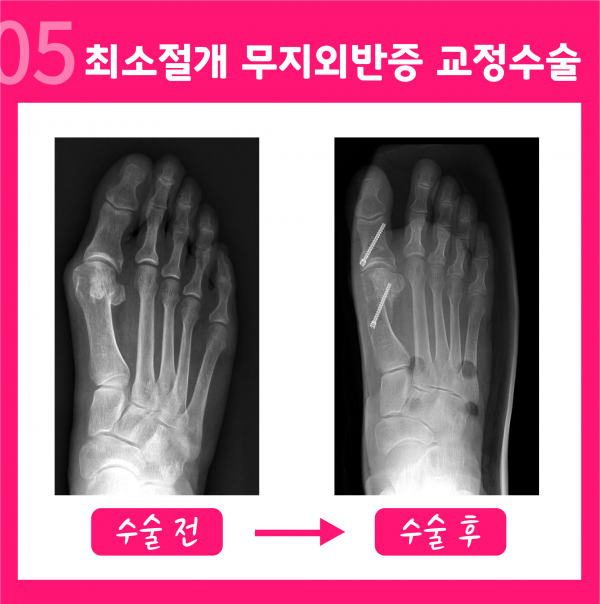 4d2a40f1d1e6d8593fbe9184d035821b_1643011