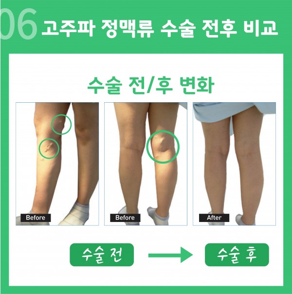 e900b7bfeaa6dad14a3be33f1210a366_1657152