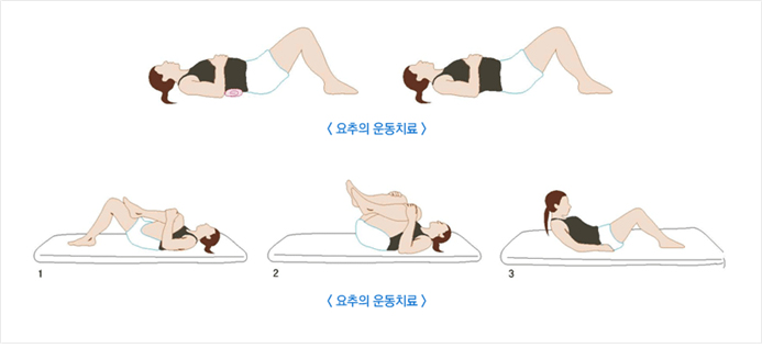요추의 운동치료