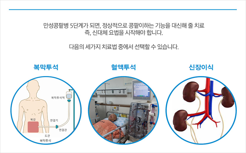 만성콩팥병 5단계가 되면, 정상적으로 콩팥이하는 기능을 대신해 줄 치료 즉, 신대체 요법을 시작해야 합니다.복막투석, 혈액투석, 신장이식 치료법 중에서 선택할 수 있습니다.