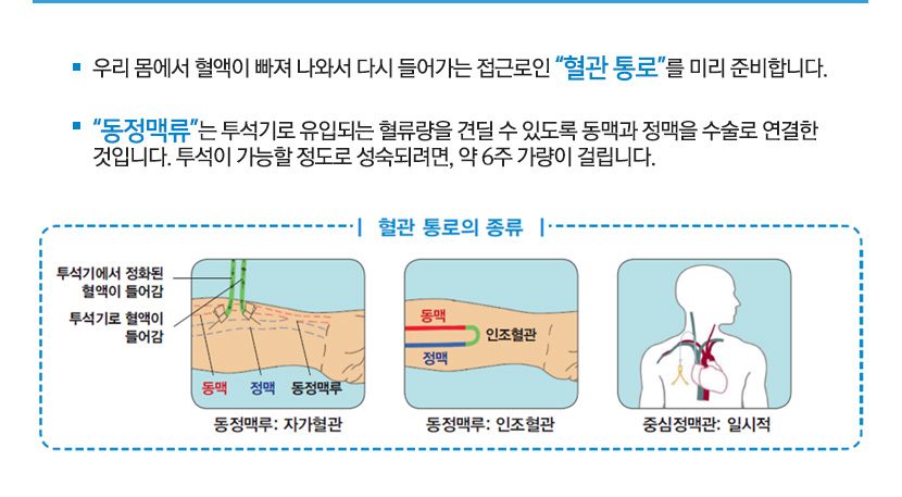 우리 몸에서 혈액이 빠져 나와서 다시 들어가는 접근로인 “혈관 통로”를 미리 준비합니다.

				“동정맥류”는 투석기로 유입되는 혈류량을 견딜 수 있도록 동맥과 정맥을 수술로 연결한 
				것입니다. 투석이 가능할 정도로 성숙되려면, 약 6주 가량이 걸립니다.