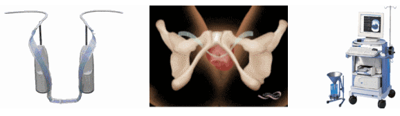 요실금술 장비사진