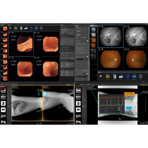 컴퓨터 영상 전송 장치 PACS 사진